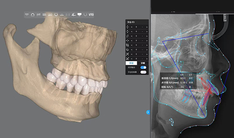 AI-Powered-Treatment-Planning-Software.jpg