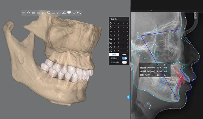 AI-Powered Treatment Planning Software
