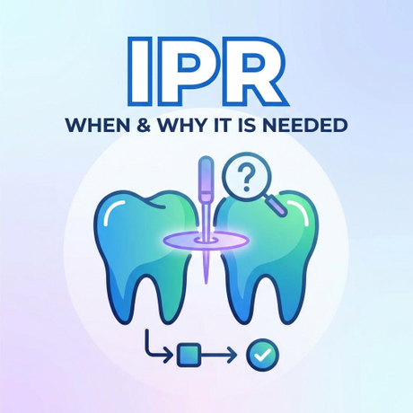 news_main_image_ipr_cover760514087189658222.jpg